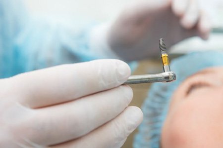 Gloved hand holding dental implant during surgery