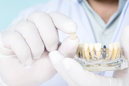 Dentist using model to show parts of dental implant