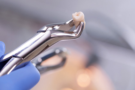 Dental pliers holding an extracted tooth
